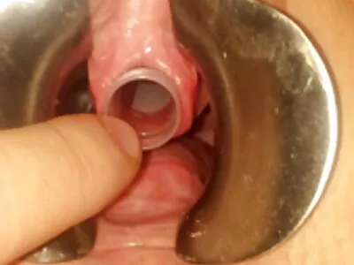 Enfermeira Euro sacanagem copula com médico e os melhores vídeos pornô brasileiro paciente pendurados